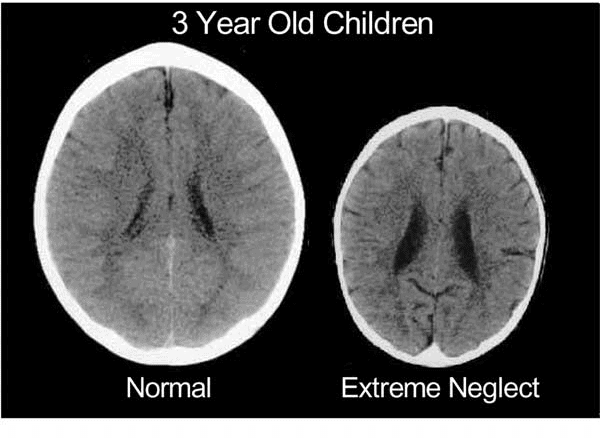 ３歳までに脳の８０％が形成される